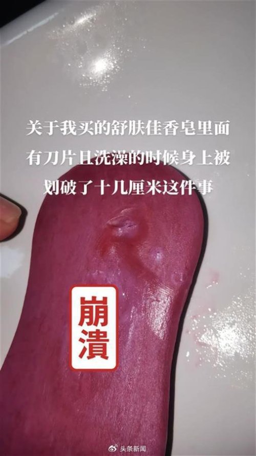 一个月出现两起 舒肤佳回应香皂出现刀片